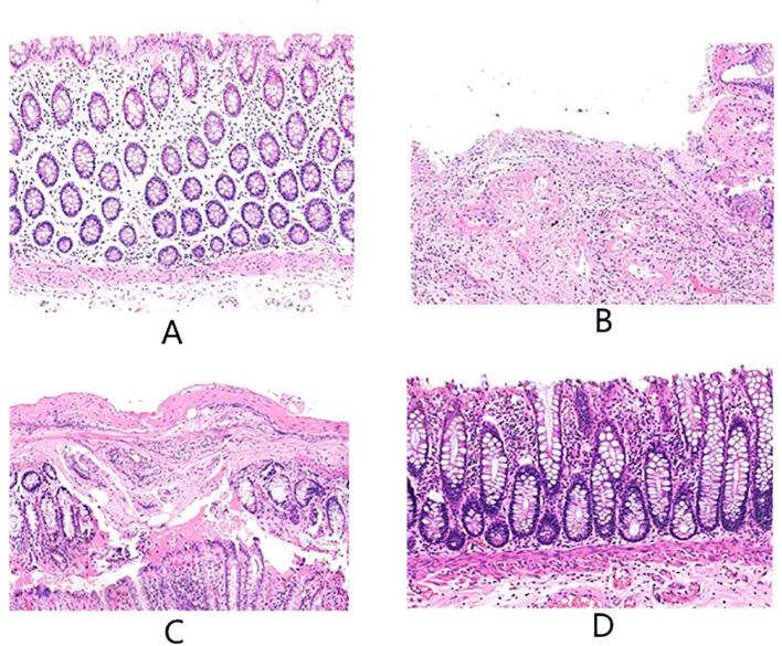 https://cdn.ncbi.nlm.nih.gov/pmc/blobs/a4d8/12197936/67ec6feb4752/fimmu-16-1590219-g001.jpg