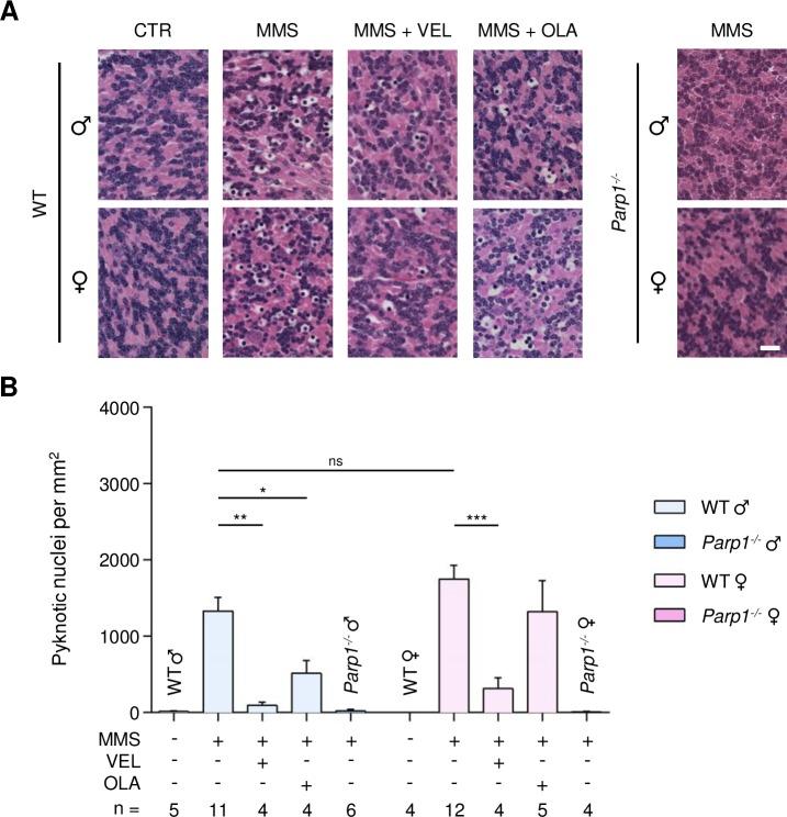 https://cdn.ncbi.nlm.nih.gov/pmc/blobs/a4d8/5620290/cdcf000404de/oncotarget-08-68707-g004.jpg