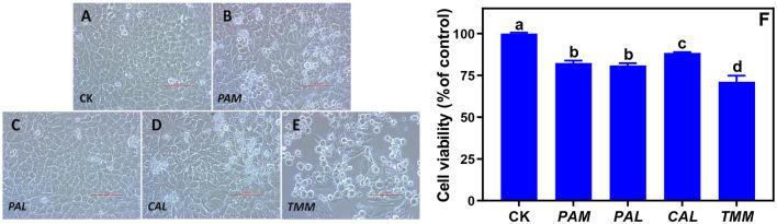 https://cdn.ncbi.nlm.nih.gov/pmc/blobs/a4d8/9670124/a8299b8f960a/fnut-09-1042300-g0003.jpg