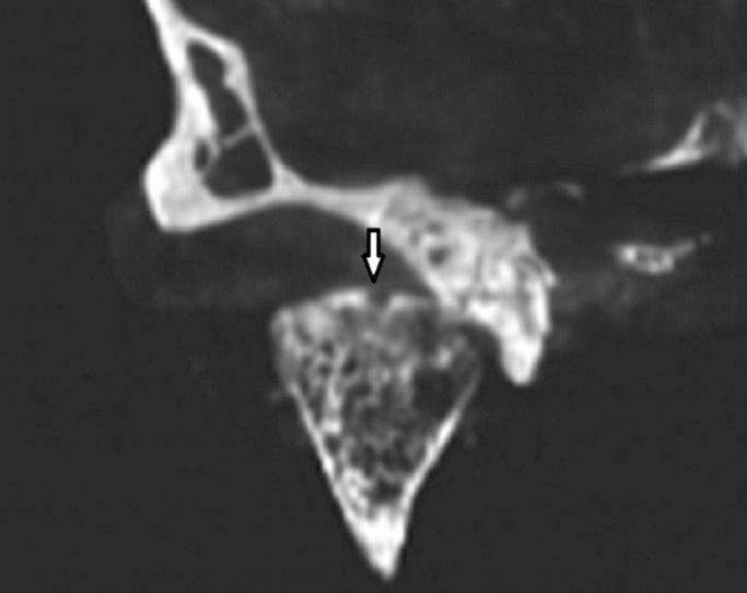 https://cdn.ncbi.nlm.nih.gov/pmc/blobs/a4e0/4368015/e15435d4d112/jced-7-e34-g002.jpg