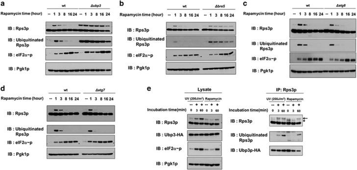 https://cdn.ncbi.nlm.nih.gov/pmc/blobs/a4e9/5704183/b2049e0651ff/emm2017128f5.jpg