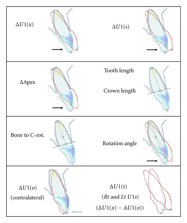 https://cdn.ncbi.nlm.nih.gov/pmc/blobs/a4eb/3424837/2bbffeaf7c82/ISRN.DENTISTRY2012-657973.001.jpg