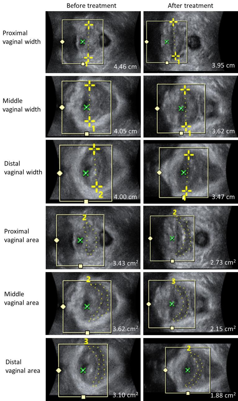 https://cdn.ncbi.nlm.nih.gov/pmc/blobs/a4ee/8891315/1f42a59008be/41598_2022_6601_Fig2_HTML.jpg