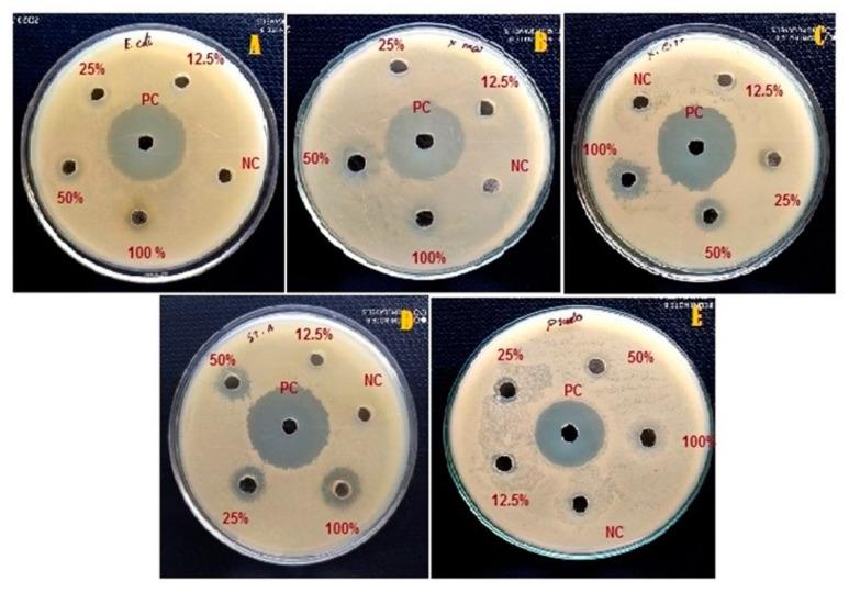 https://cdn.ncbi.nlm.nih.gov/pmc/blobs/a4f4/8069095/a8789378340b/insects-12-00340-g005.jpg