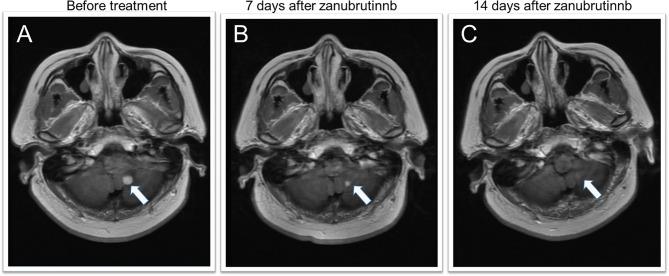 https://cdn.ncbi.nlm.nih.gov/pmc/blobs/a4f4/8739956/30ec84e3485e/fonc-11-760405-g002.jpg