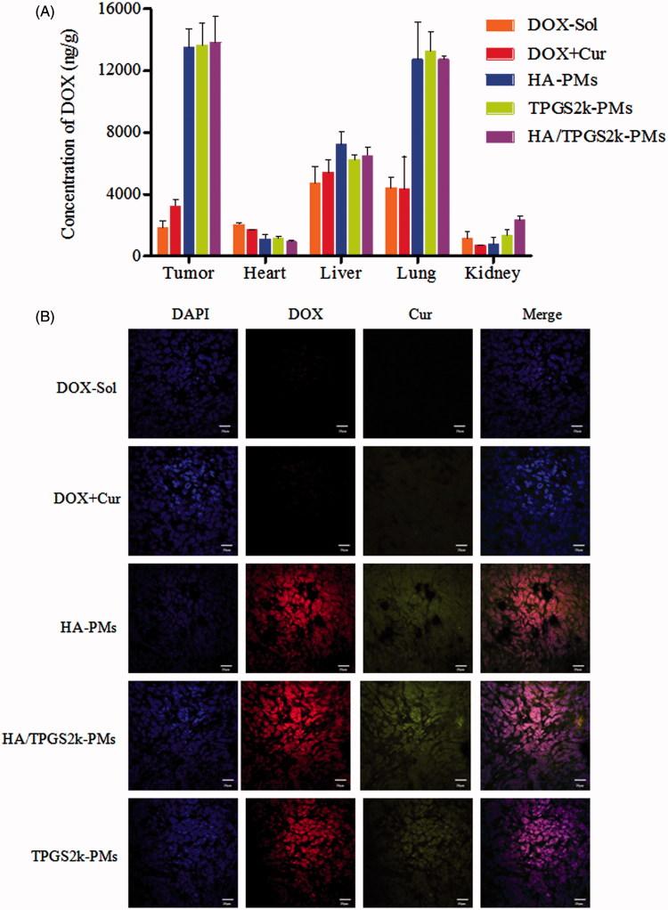https://cdn.ncbi.nlm.nih.gov/pmc/blobs/a4f9/6058673/bb359a06b77d/IDRD_A_1428385_F0004_C.jpg
