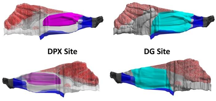 https://cdn.ncbi.nlm.nih.gov/pmc/blobs/a4fb/9887723/ca8cf295b34d/kfac119f2.jpg