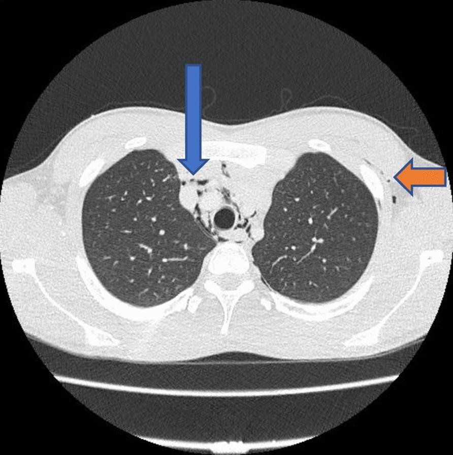 https://cdn.ncbi.nlm.nih.gov/pmc/blobs/a504/11969771/11a0cba0d701/13256_2025_5053_Fig2_HTML.jpg