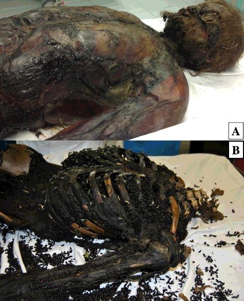 https://cdn.ncbi.nlm.nih.gov/pmc/blobs/a513/6197082/9ad06c398bd9/TFSR_A_1418622_F0002_OC.jpg
