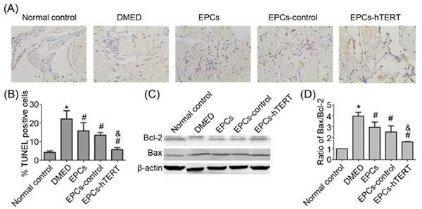 https://cdn.ncbi.nlm.nih.gov/pmc/blobs/a518/5129934/46a622bd3c62/oncotarget-07-39302-g006.jpg