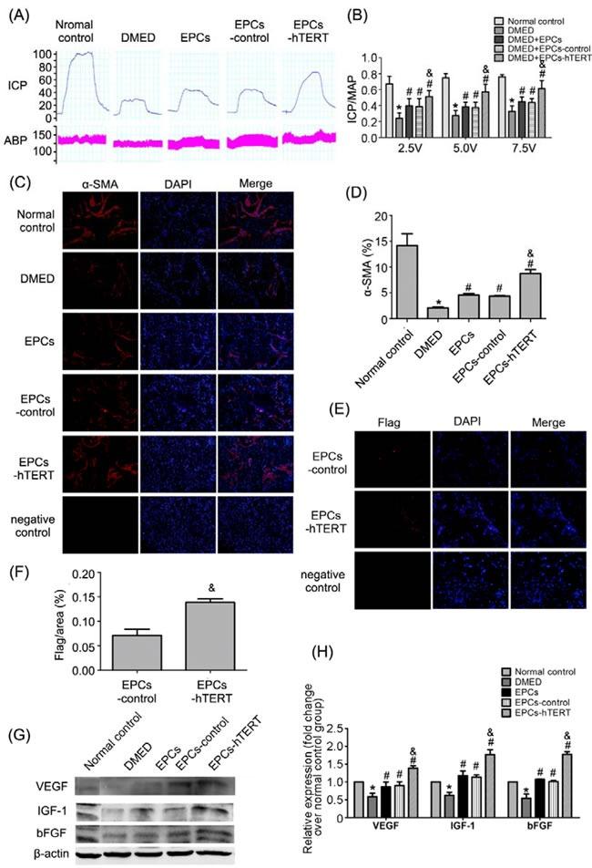 https://cdn.ncbi.nlm.nih.gov/pmc/blobs/a518/5129934/db7417ce2c44/oncotarget-07-39302-g004.jpg