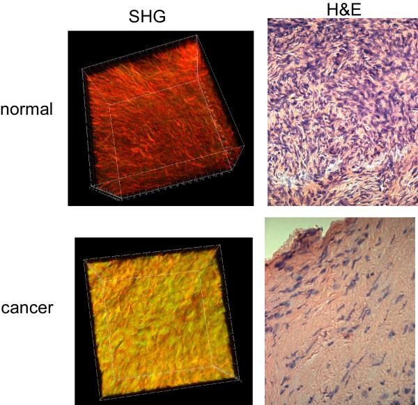 https://cdn.ncbi.nlm.nih.gov/pmc/blobs/a524/2841668/d7509e4b7be3/1471-2407-10-94-2.jpg