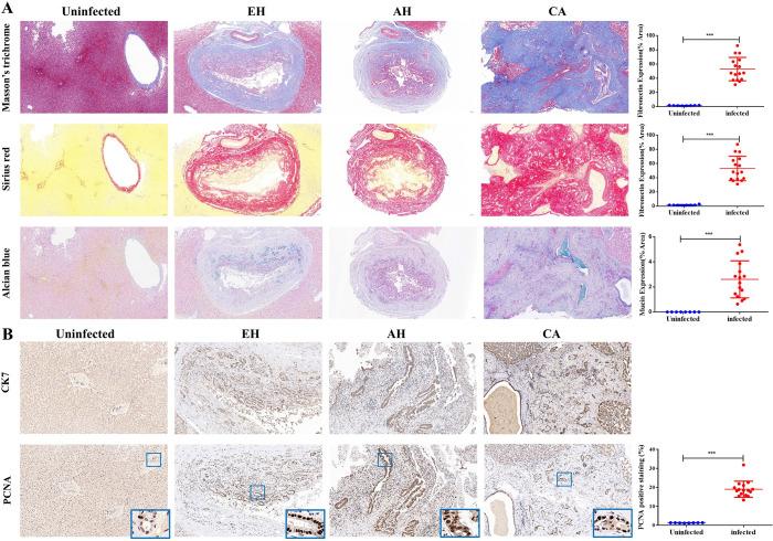 https://cdn.ncbi.nlm.nih.gov/pmc/blobs/a529/11378715/21e5515ac848/parasite-31-53-fig2.jpg