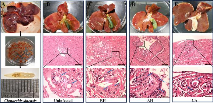 https://cdn.ncbi.nlm.nih.gov/pmc/blobs/a529/11378715/dada4bcaf87b/parasite-31-53-fig1.jpg