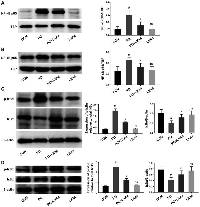 https://cdn.ncbi.nlm.nih.gov/pmc/blobs/a52f/7992923/9ebcf0fe3978/IJMM-47-05-04919-g05.jpg