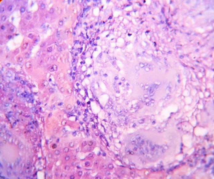 https://cdn.ncbi.nlm.nih.gov/pmc/blobs/a532/5604103/4428e0cc3391/ijp-11-427-g002.jpg
