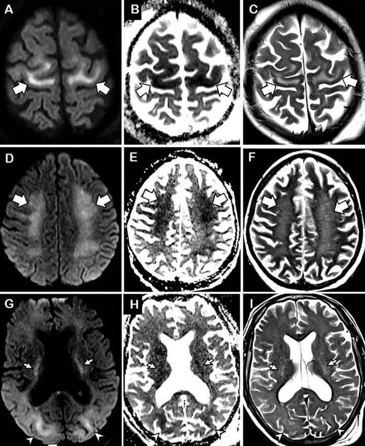 https://cdn.ncbi.nlm.nih.gov/pmc/blobs/a539/7507998/7c97d5dbf764/radiol.2020202040.fig2.jpg