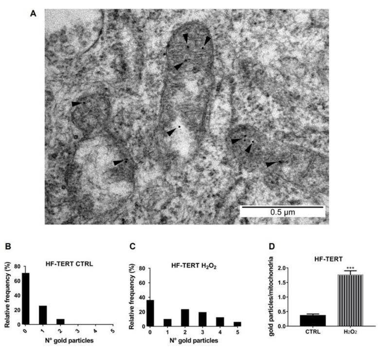 https://cdn.ncbi.nlm.nih.gov/pmc/blobs/a540/10002448/d0e89fdee882/ijms-24-04450-g006.jpg