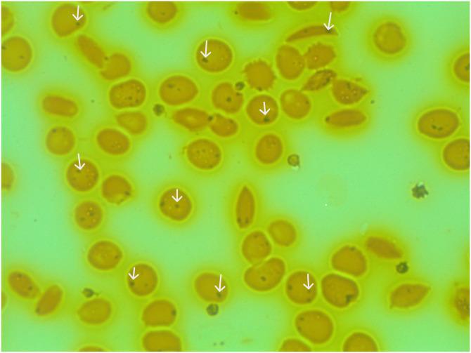 https://cdn.ncbi.nlm.nih.gov/pmc/blobs/a540/10194925/dace3842222a/pgph.0001552.g001.jpg