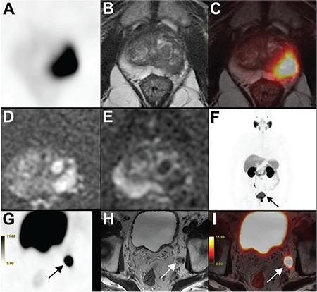 https://cdn.ncbi.nlm.nih.gov/pmc/blobs/a549/6746007/8b0cf5ed44be/MIRT-28-104-g3.jpg