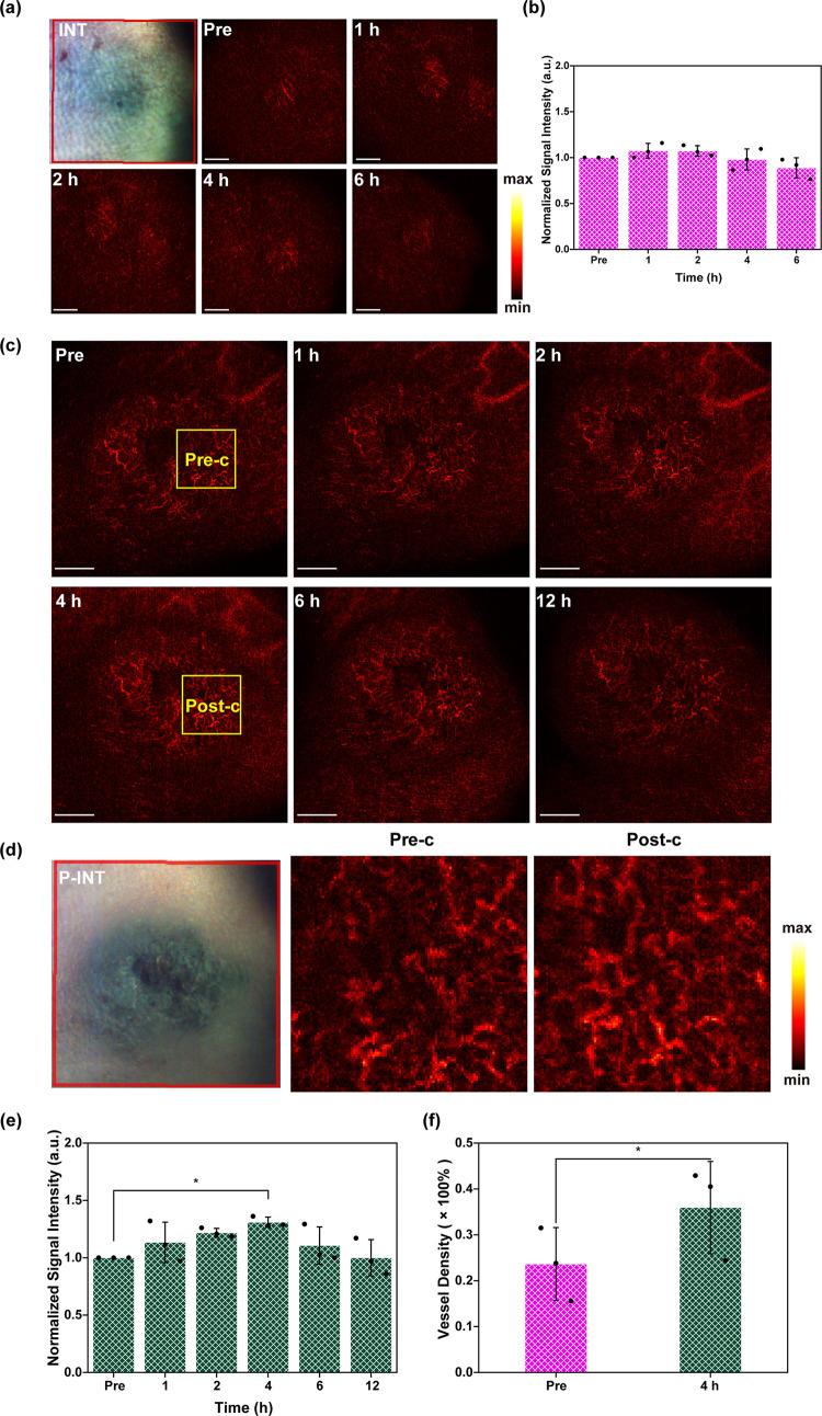 https://cdn.ncbi.nlm.nih.gov/pmc/blobs/a54c/10976961/36a41fef6877/nn4c01204_0005.jpg