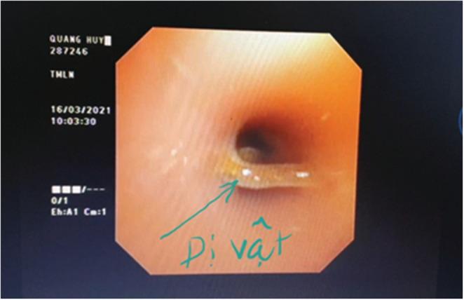 https://cdn.ncbi.nlm.nih.gov/pmc/blobs/a54d/9900234/a770d2a65fcf/CCR3-11-e6914-g004.jpg