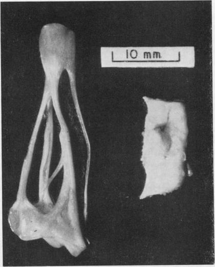 https://cdn.ncbi.nlm.nih.gov/pmc/blobs/a551/1018669/5b61a4713f69/thorax00065-0071-a.jpg