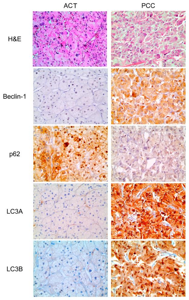 https://cdn.ncbi.nlm.nih.gov/pmc/blobs/a558/8508962/699064d10036/ijms-22-10490-g001.jpg