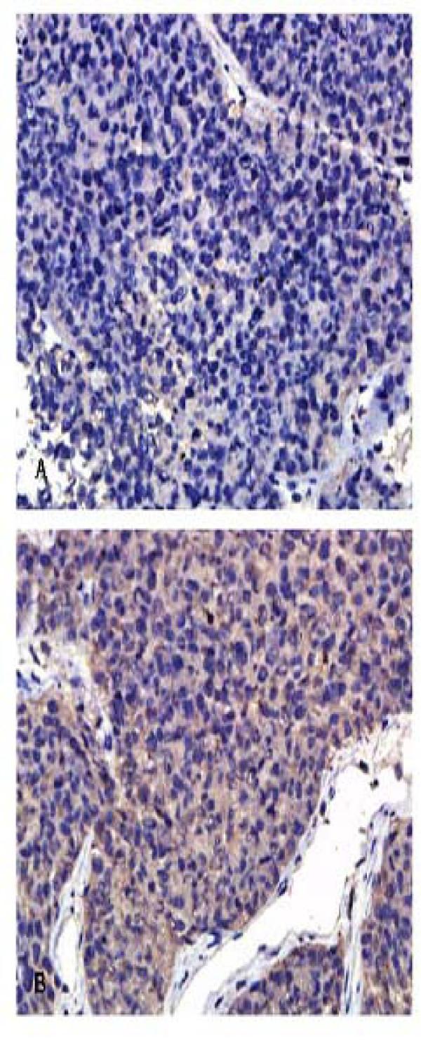 https://cdn.ncbi.nlm.nih.gov/pmc/blobs/a55a/2845108/de44ee80b183/1756-9966-29-17-4.jpg