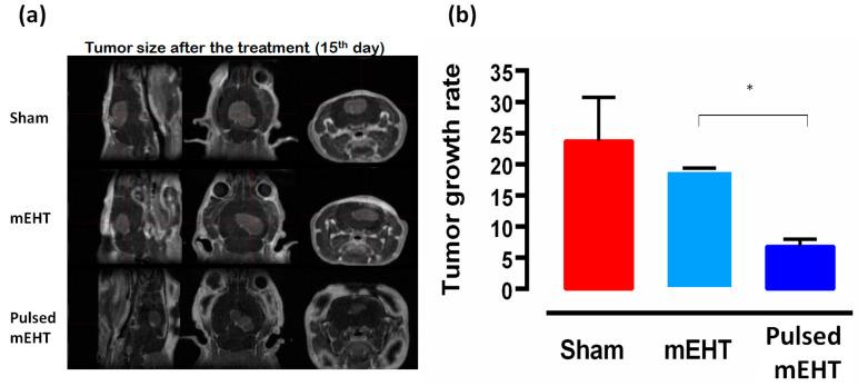 https://cdn.ncbi.nlm.nih.gov/pmc/blobs/a55c/11273694/e27fb78b5d72/bioengineering-11-00725-g021.jpg