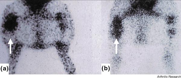 https://cdn.ncbi.nlm.nih.gov/pmc/blobs/a561/3240138/ab5cf6021d50/ar562-2.jpg