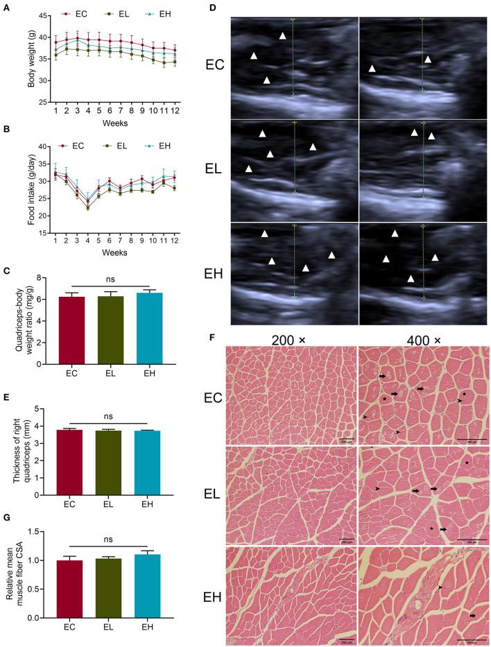 https://cdn.ncbi.nlm.nih.gov/pmc/blobs/a565/8645596/d11d592e069f/fmed-08-755803-g0002.jpg