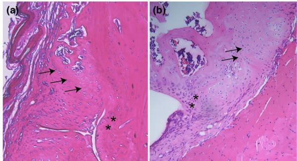 https://cdn.ncbi.nlm.nih.gov/pmc/blobs/a567/1906799/f11cd213b8a3/ar2135-2.jpg