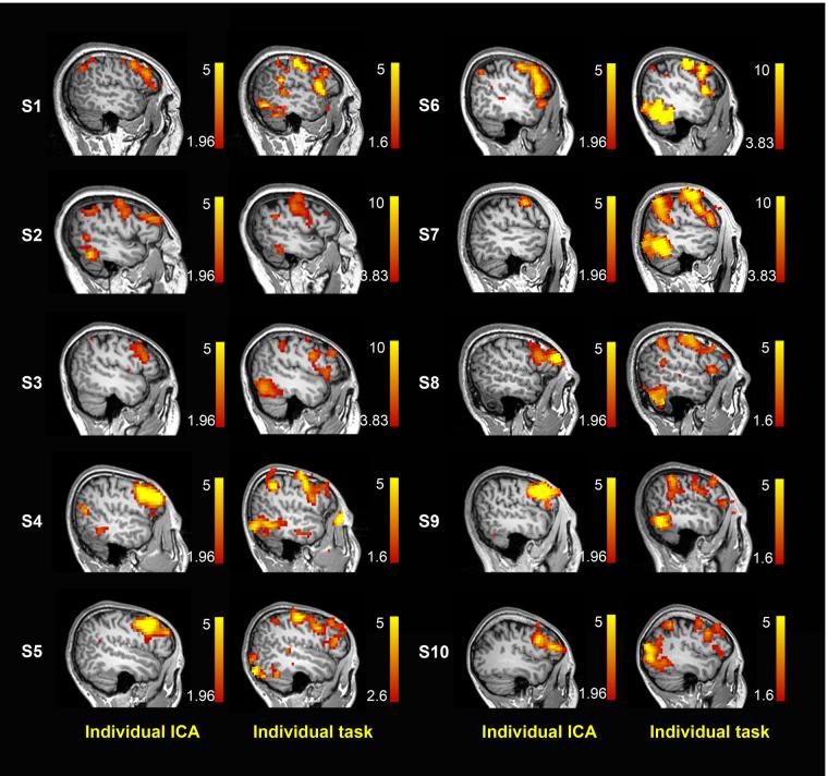 https://cdn.ncbi.nlm.nih.gov/pmc/blobs/a56a/5653800/1f4926146efd/41598_2017_14248_Fig3_HTML.jpg