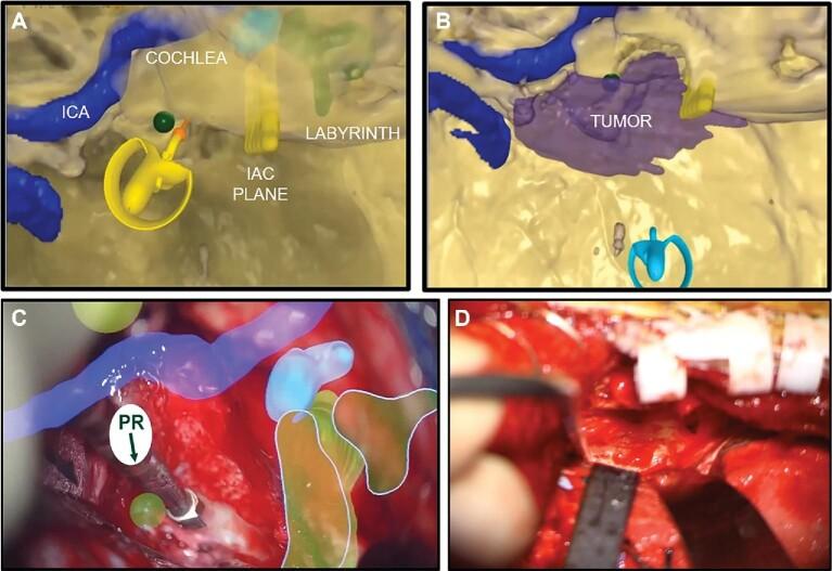 https://cdn.ncbi.nlm.nih.gov/pmc/blobs/a56b/8453400/048f733012b6/opab188fig1.jpg