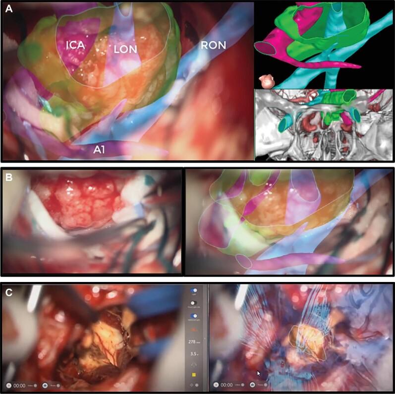 https://cdn.ncbi.nlm.nih.gov/pmc/blobs/a56b/8453400/8dd026d1ca68/opab188fig2.jpg