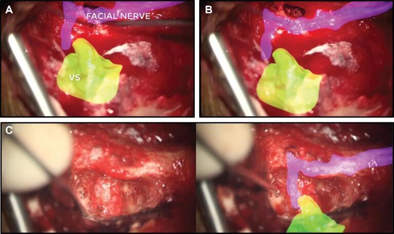 https://cdn.ncbi.nlm.nih.gov/pmc/blobs/a56b/8453400/f2c7474813d7/opab188fig4.jpg