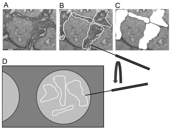 https://cdn.ncbi.nlm.nih.gov/pmc/blobs/a56f/2826342/f67885f4e405/1746-1596-5-10-1.jpg