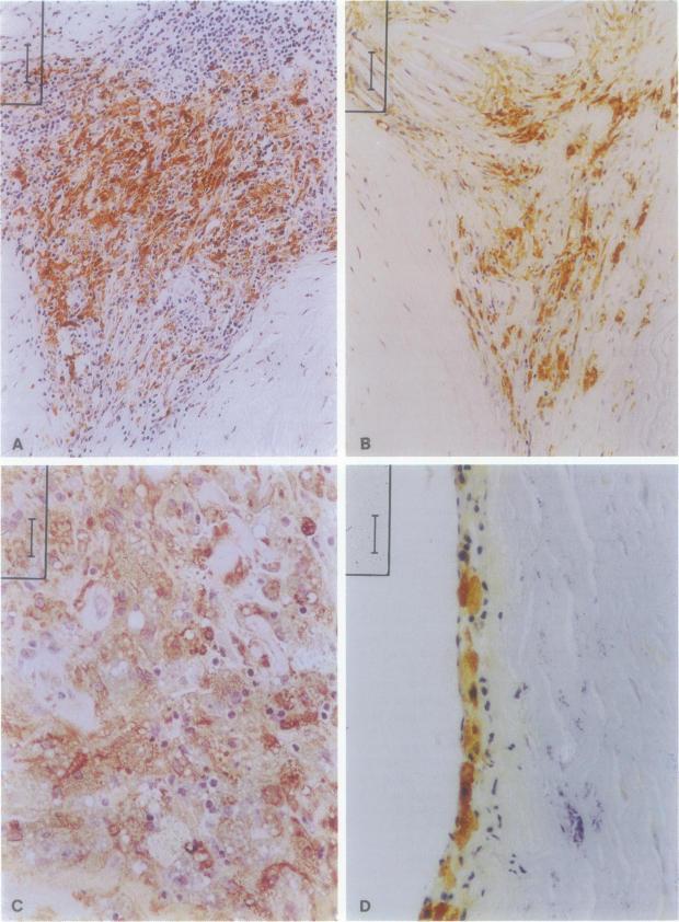 https://cdn.ncbi.nlm.nih.gov/pmc/blobs/a574/1858580/2c440561316e/amjpathol00017-0097-a.jpg