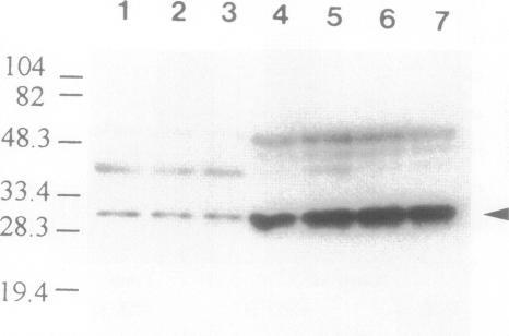 https://cdn.ncbi.nlm.nih.gov/pmc/blobs/a574/1858580/3cac47e1cb1d/amjpathol00017-0101-b.jpg