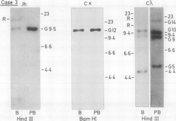 https://cdn.ncbi.nlm.nih.gov/pmc/blobs/a584/1141227/f252a73bfe0a/jclinpath00331-0030-a.jpg