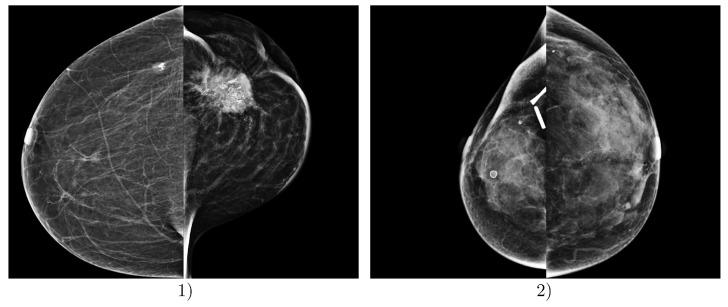 https://cdn.ncbi.nlm.nih.gov/pmc/blobs/a587/11172127/696f842b9756/diagnostics-14-01117-g007.jpg