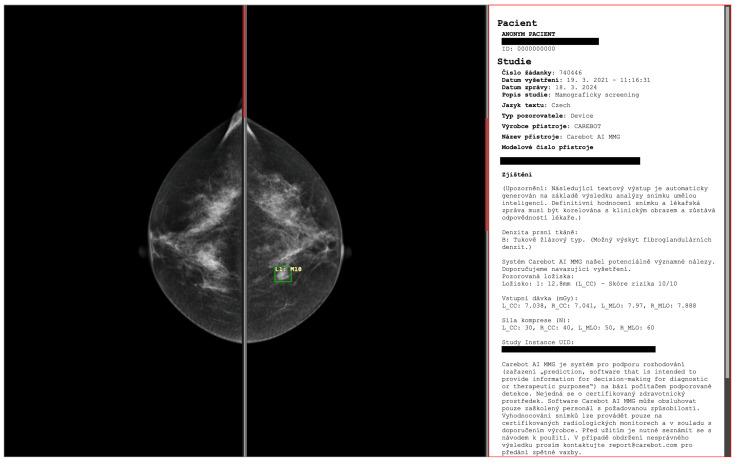 https://cdn.ncbi.nlm.nih.gov/pmc/blobs/a587/11172127/c34d8ea03d13/diagnostics-14-01117-g002.jpg