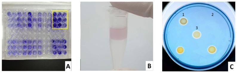 https://cdn.ncbi.nlm.nih.gov/pmc/blobs/a587/9855430/c3251adf6c61/biomedicines-11-00054-g001.jpg
