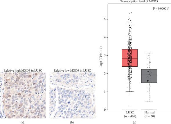 https://cdn.ncbi.nlm.nih.gov/pmc/blobs/a588/12097849/e5510f4fb85c/IJG2025-7355595.001.jpg
