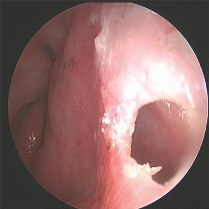 https://cdn.ncbi.nlm.nih.gov/pmc/blobs/a58a/5805433/63423c469d94/medi-97-e9758-g005.jpg