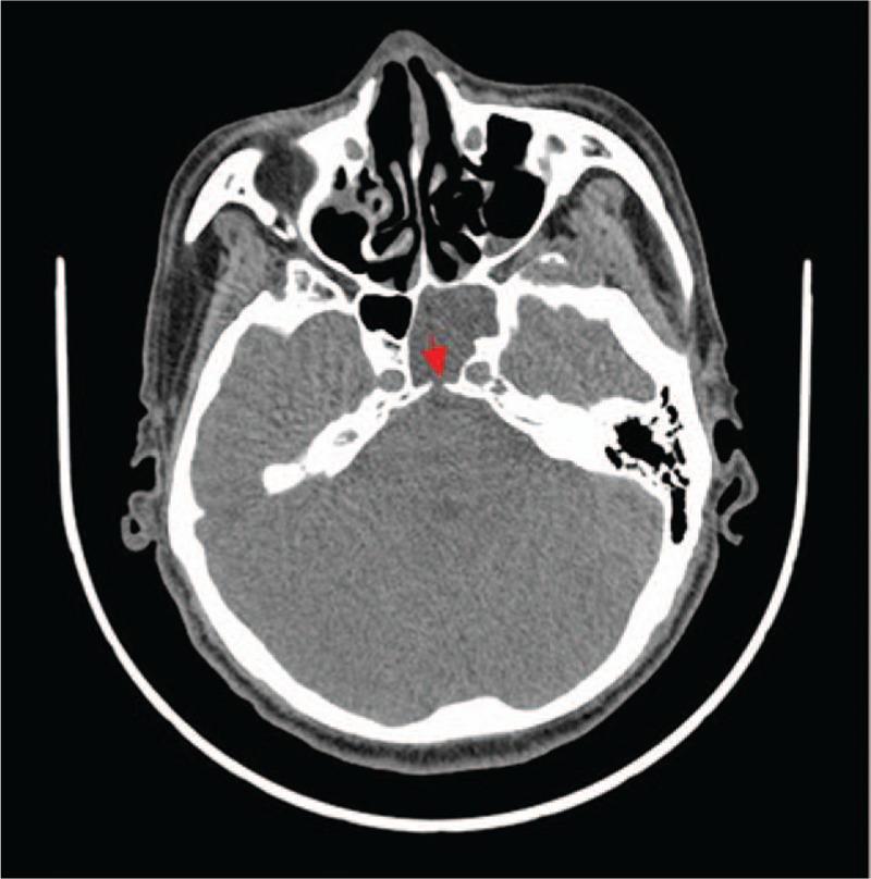 https://cdn.ncbi.nlm.nih.gov/pmc/blobs/a58a/5805433/d7820fb5ce45/medi-97-e9758-g002.jpg