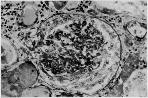 https://cdn.ncbi.nlm.nih.gov/pmc/blobs/a58d/475889/a8bae020a777/jclinpath00145-0051-b.jpg