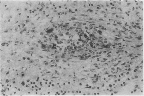 https://cdn.ncbi.nlm.nih.gov/pmc/blobs/a58d/475889/d1dfb2d4ac8d/jclinpath00145-0054-a.jpg
