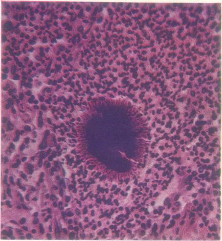 https://cdn.ncbi.nlm.nih.gov/pmc/blobs/a58e/1019236/0b8d8457ac7b/thorax00046-0034-a.jpg